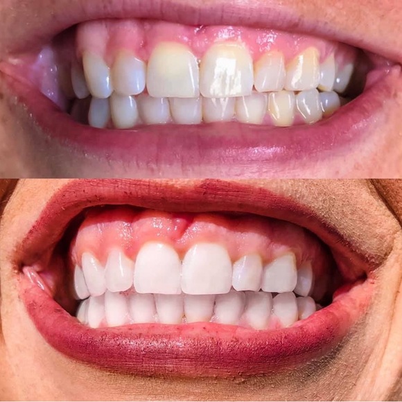 AP24 whitening toothpaste - Picture 2 of 7